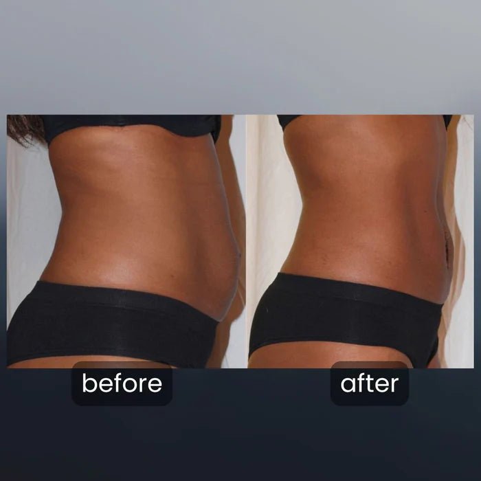 4 - in - 1 lymphatic drainage massager - veelora