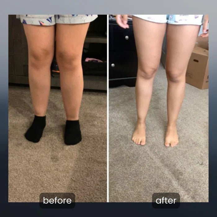 4 - in - 1 lymphatic drainage massager - veelora