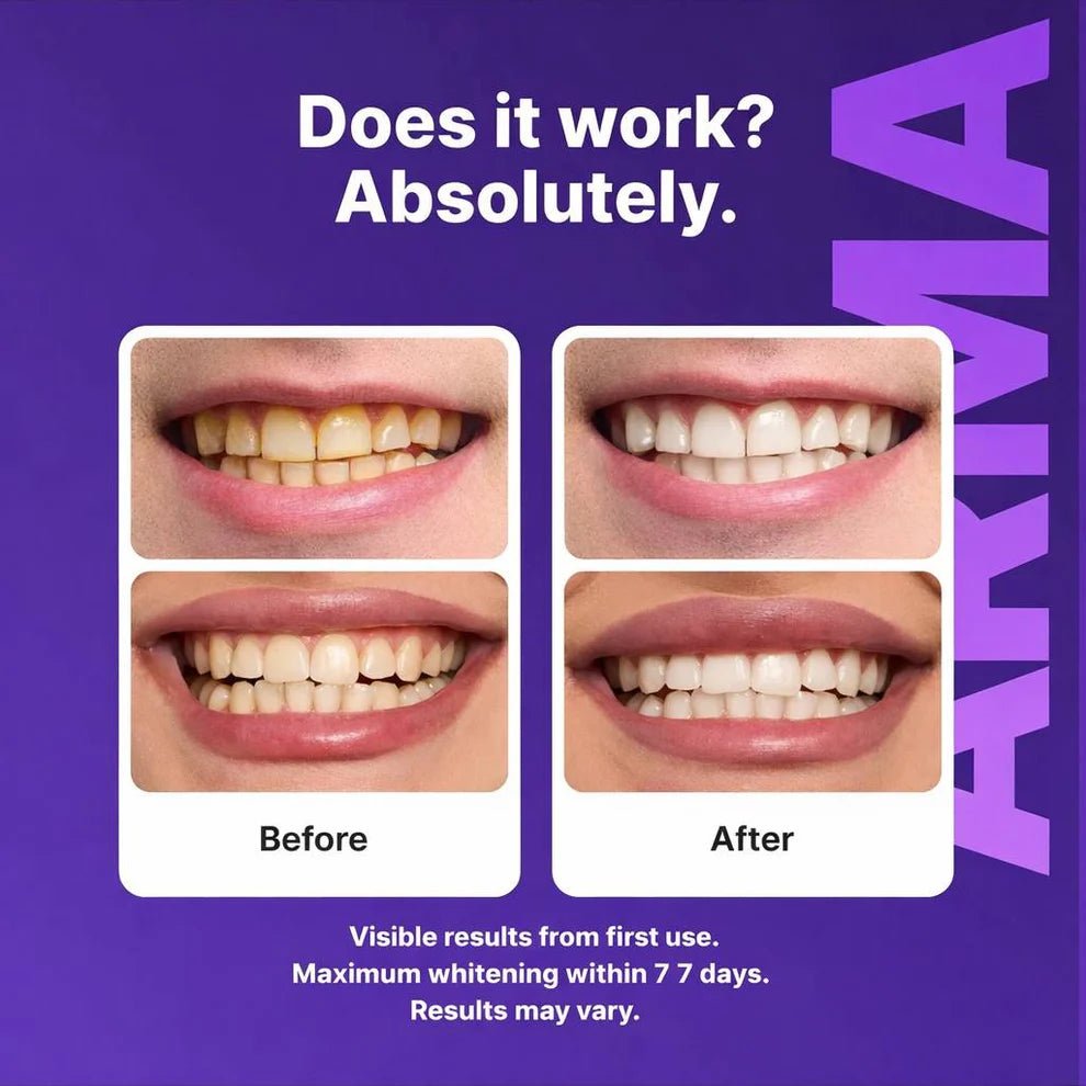 Purple Teeth Whitening Strips (Gen 2) - veelora